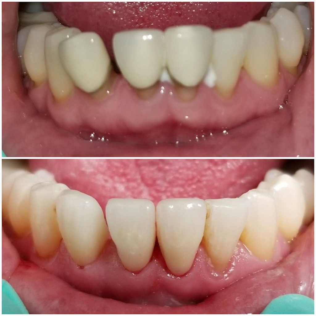 JH Dental