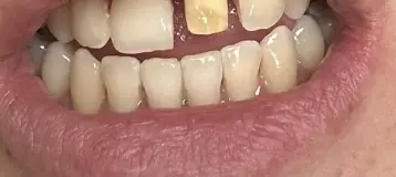 Aspen Dental