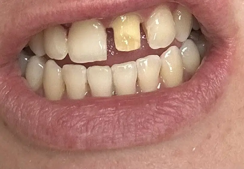 Aspen Dental