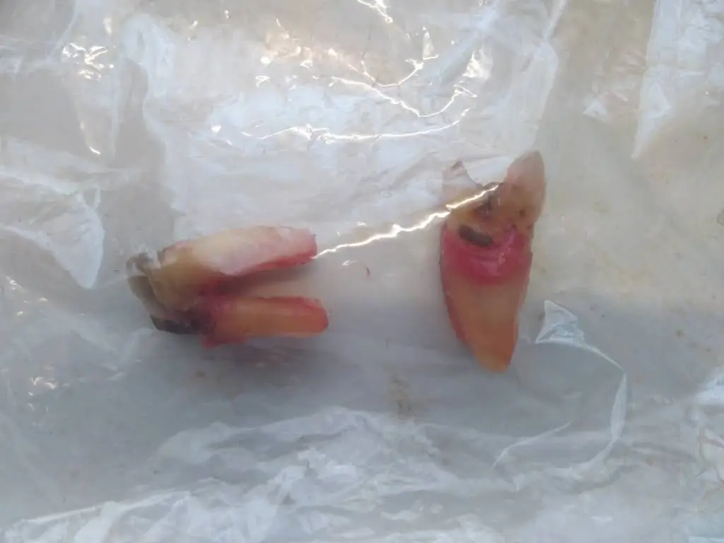 Aspen Dental