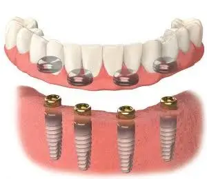 Berry Dental
