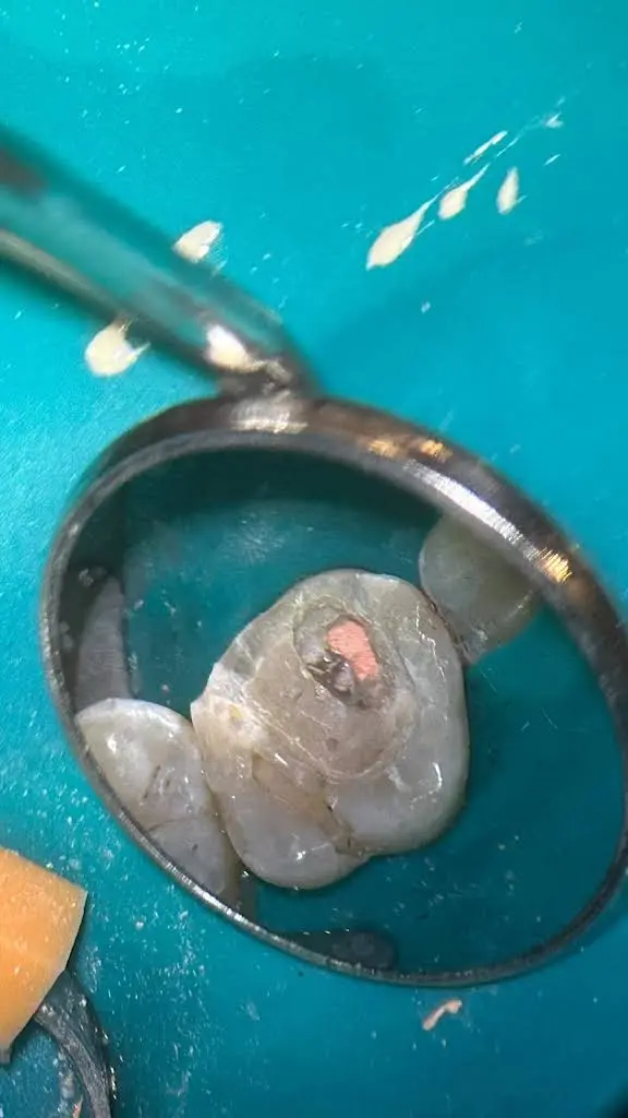 Grover Dental Care - Hayden