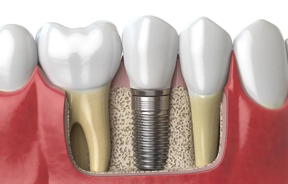 Tooth Buds Dentistry
