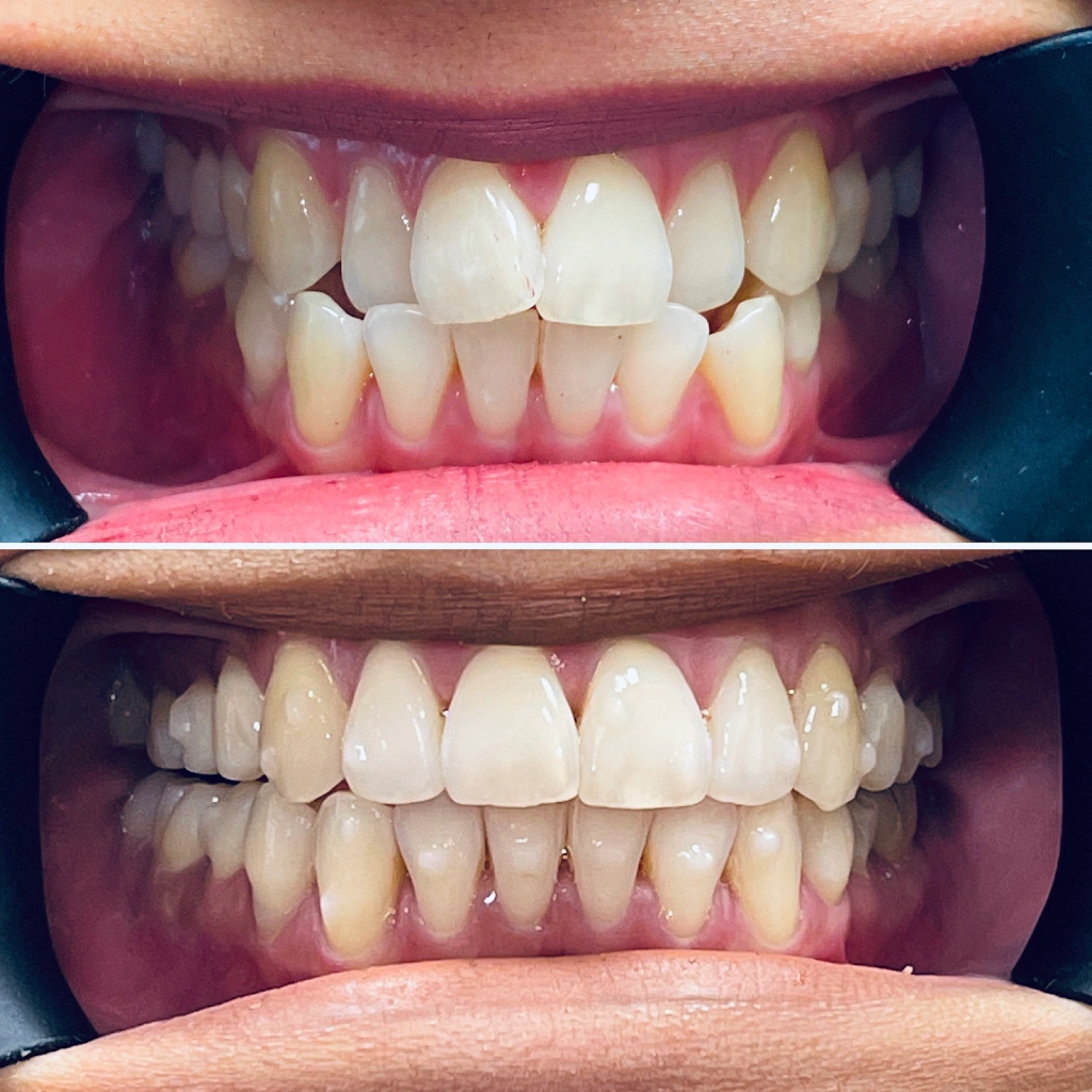 Sequoia Dental