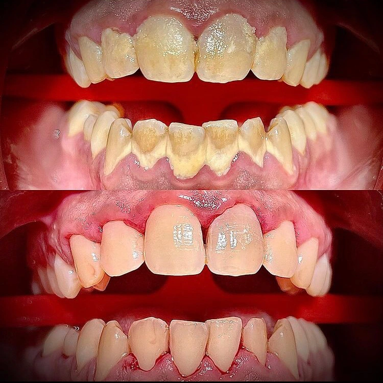 Ladd Dental Group