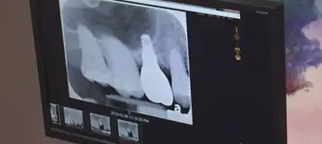 Perio Plastic & Implantology Center of Kokomo