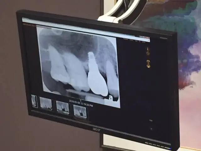 Perio Plastic & Implantology Center of Kokomo