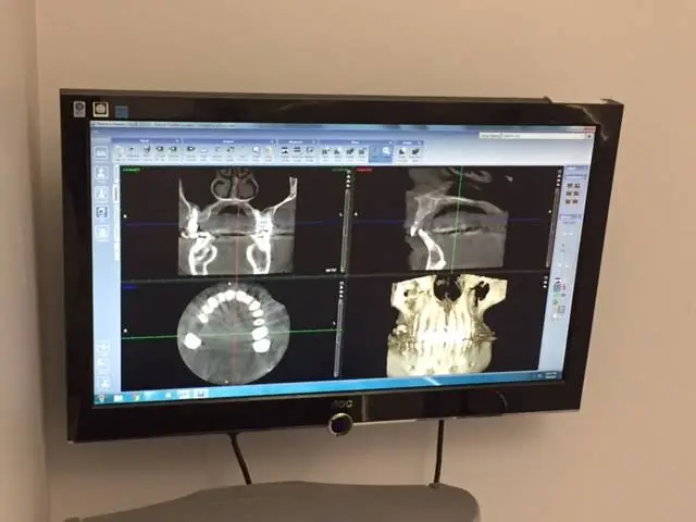 Oral Surgery Center of Kokomo