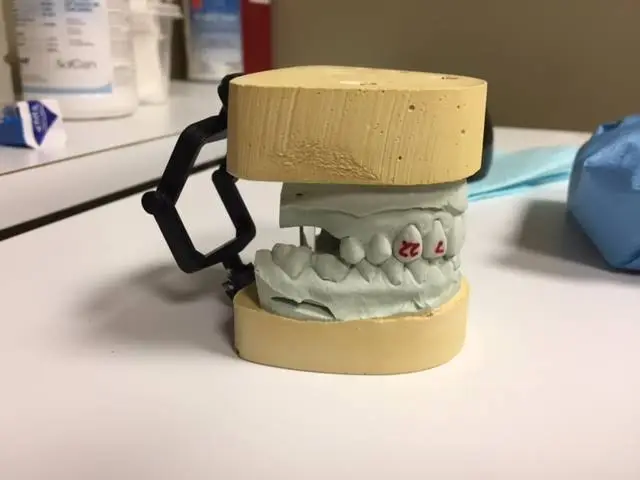 Oral Surgery Center of Kokomo