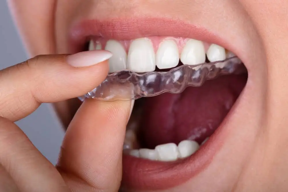 Great Lakes Family Dental Group - Muncie