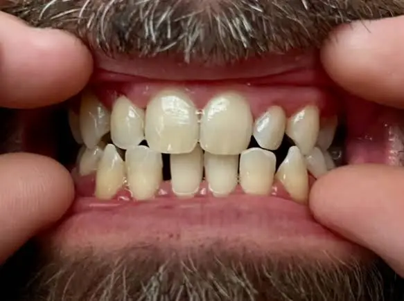 Yorktown Family Dentistry
