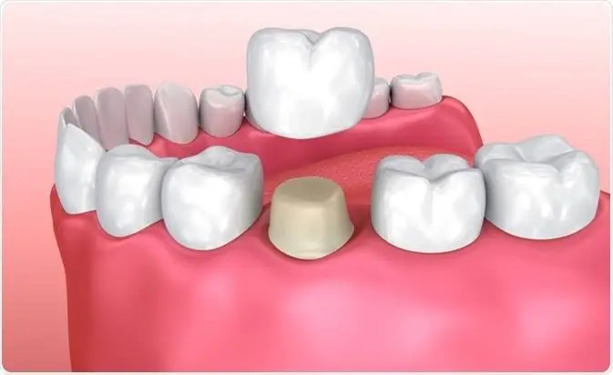 Main West Dental