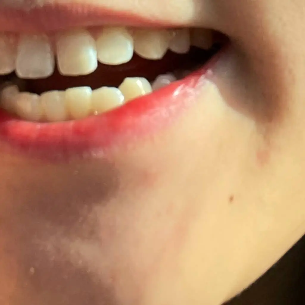University Avenue Dental
