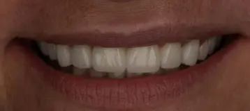Kitchener Waterloo Prosthodontics