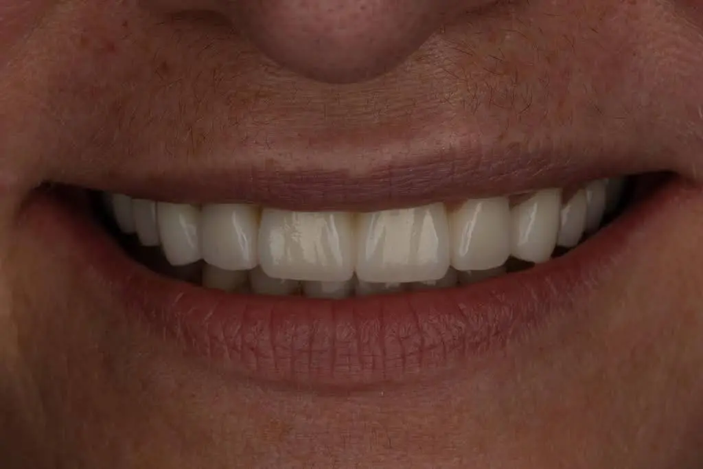 Kitchener Waterloo Prosthodontics