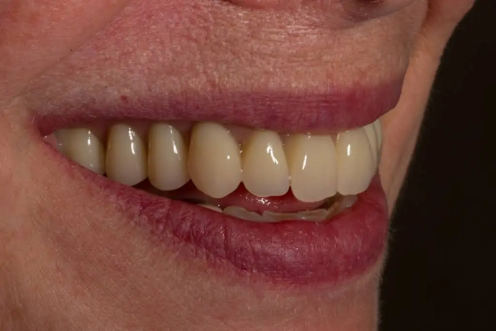 Kitchener Waterloo Prosthodontics