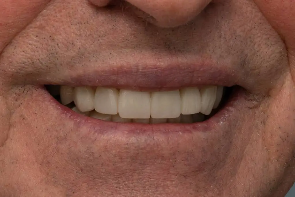 Kitchener Waterloo Prosthodontics