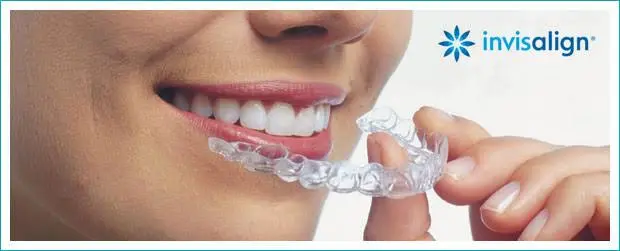 Kitchener Dentist Sherwood Dental