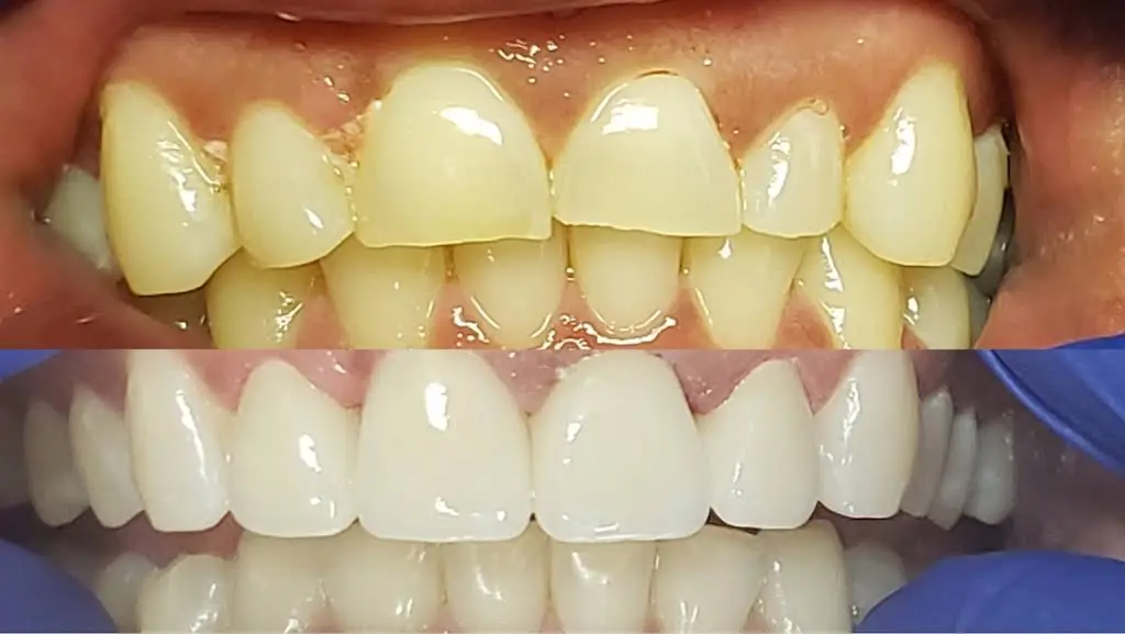 U Smile Dentistry