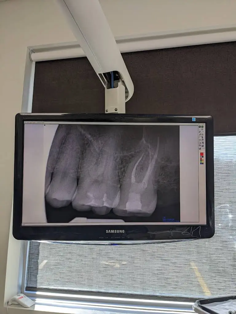 Endodontic Care