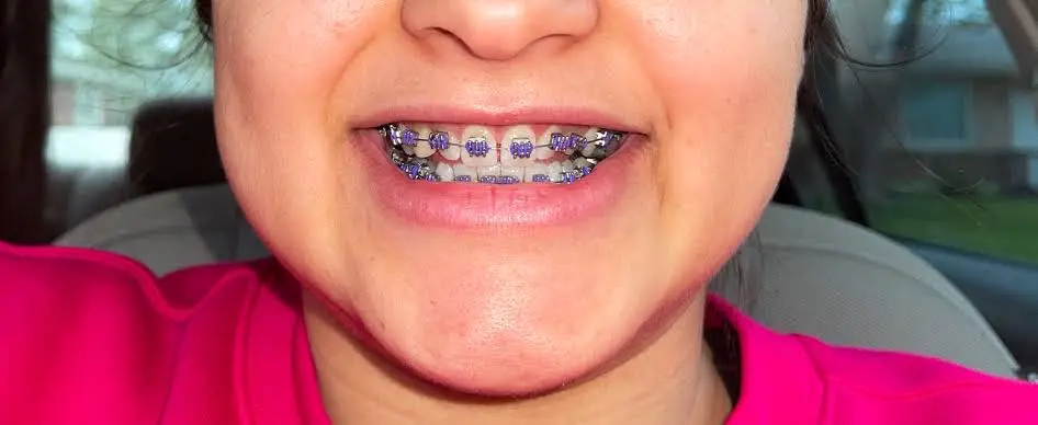 Avila Orthodontics - Muncie