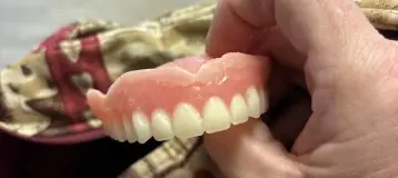 Affordable Dentures & Implants
