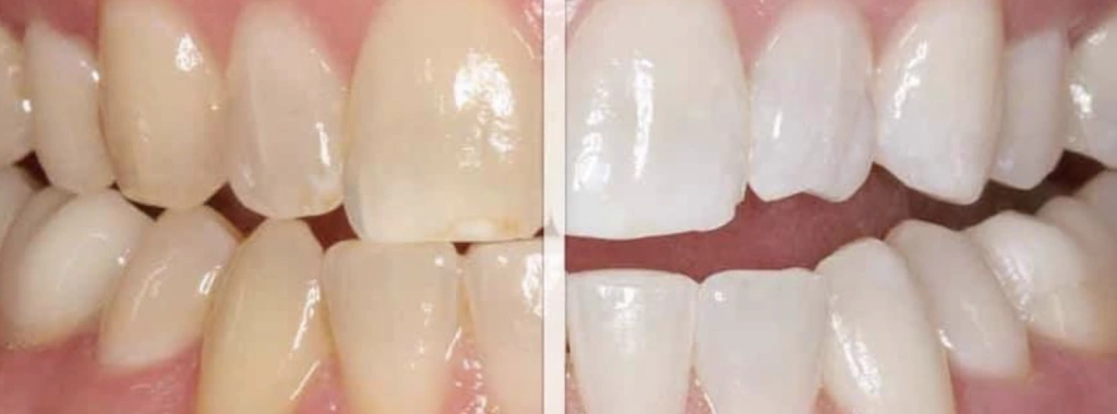 Raintree Dental