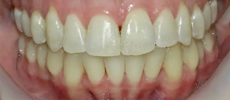 Lily Dental - Hamilton