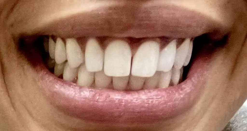 Hamilton City Dental