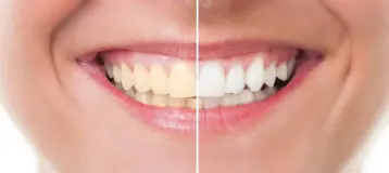 Headwaters Dental
