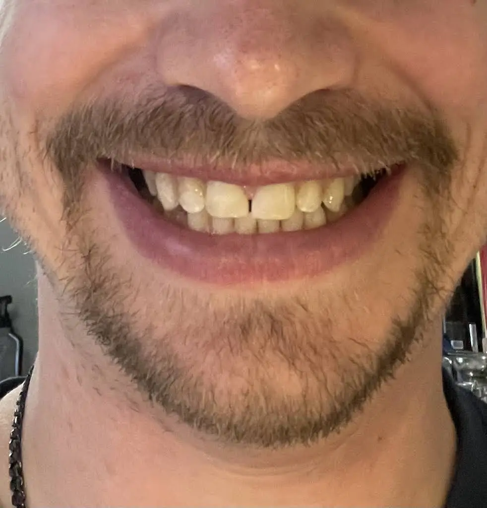 Erin Dental Care