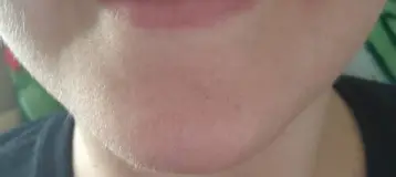 Cherry & Williams Dental
