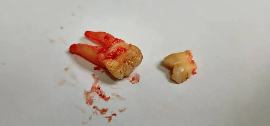 Corner Dental