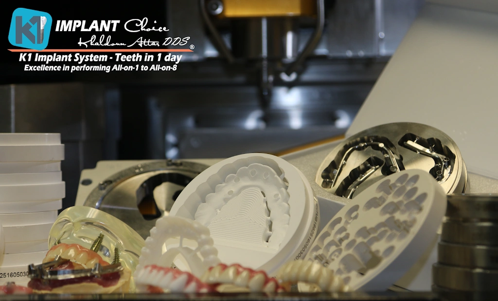 K1 Implant Choice