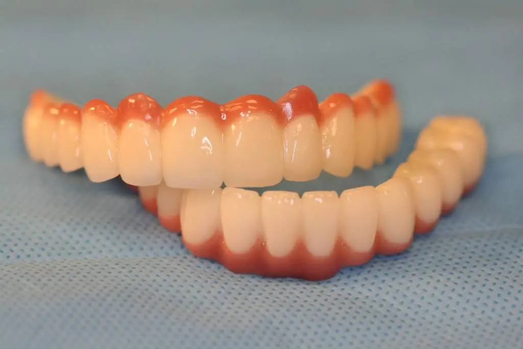 K1 Implant Choice