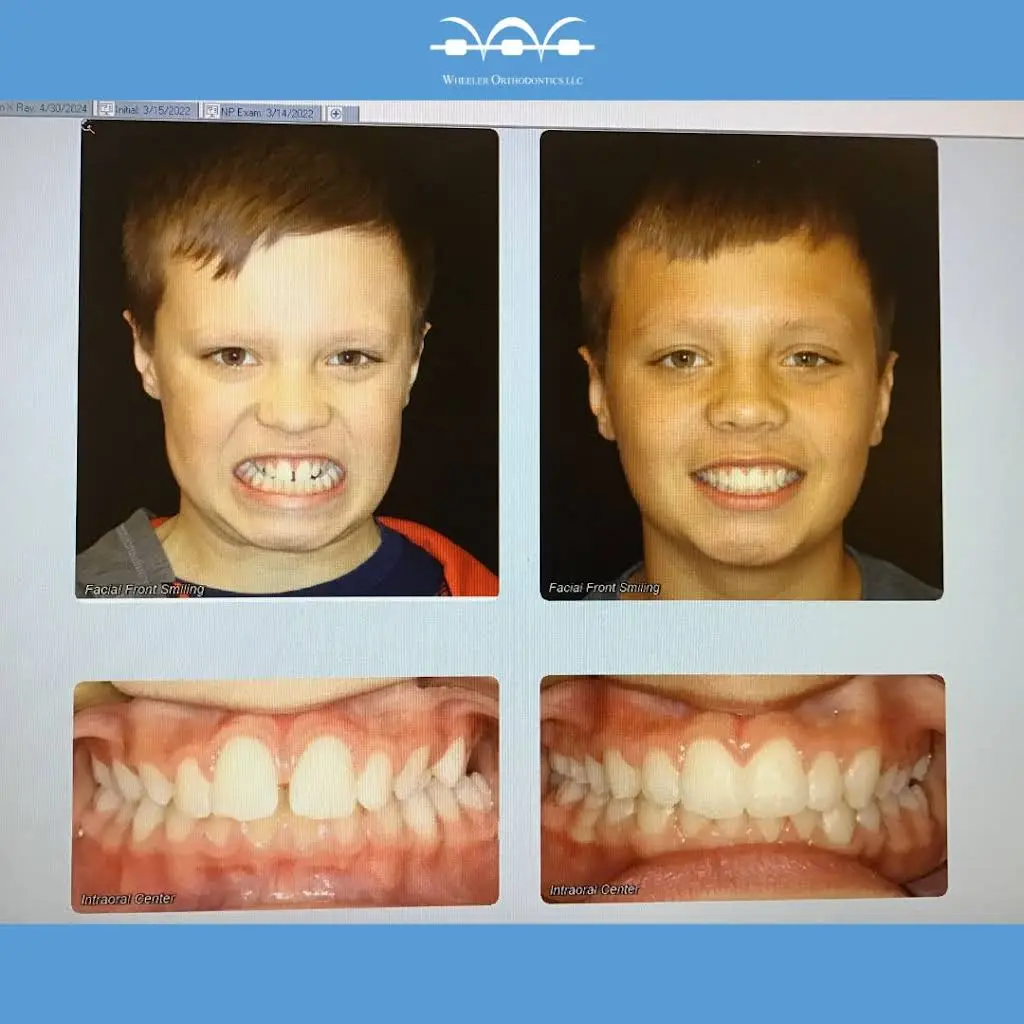 Wheeler Orthodontics, LLC