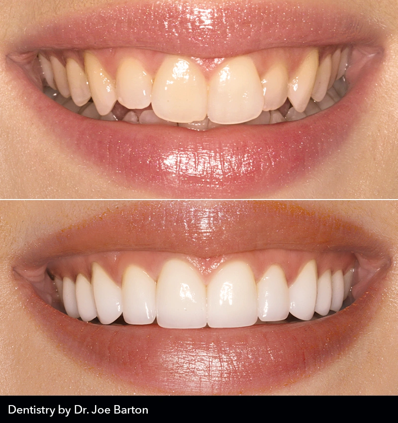 MicroDental Hamilton