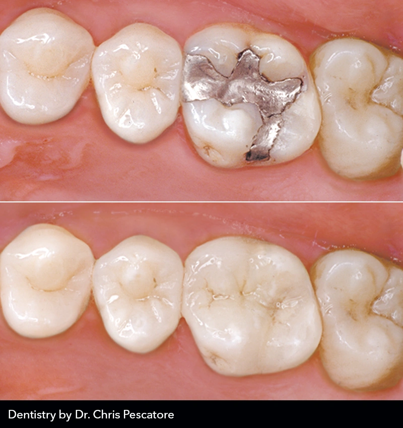 MicroDental Hamilton
