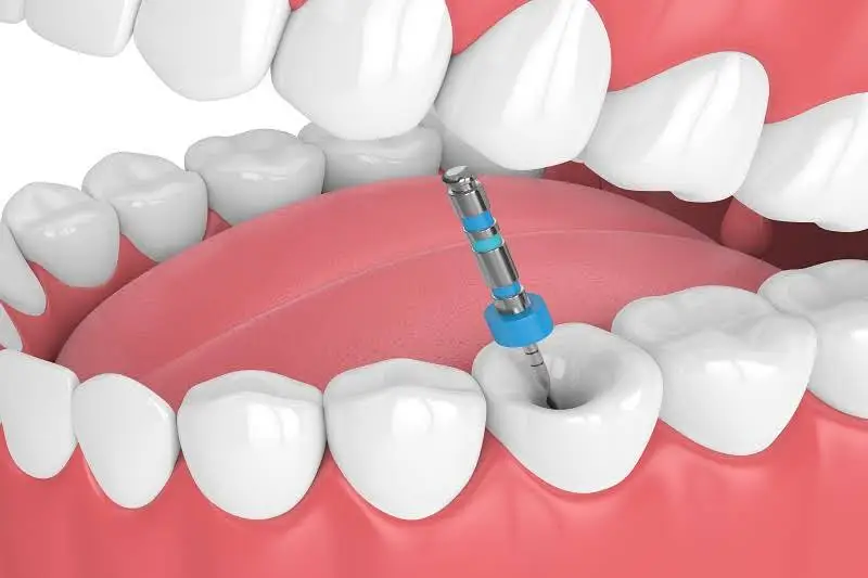 Kennedy North Dentistry - Caledon
