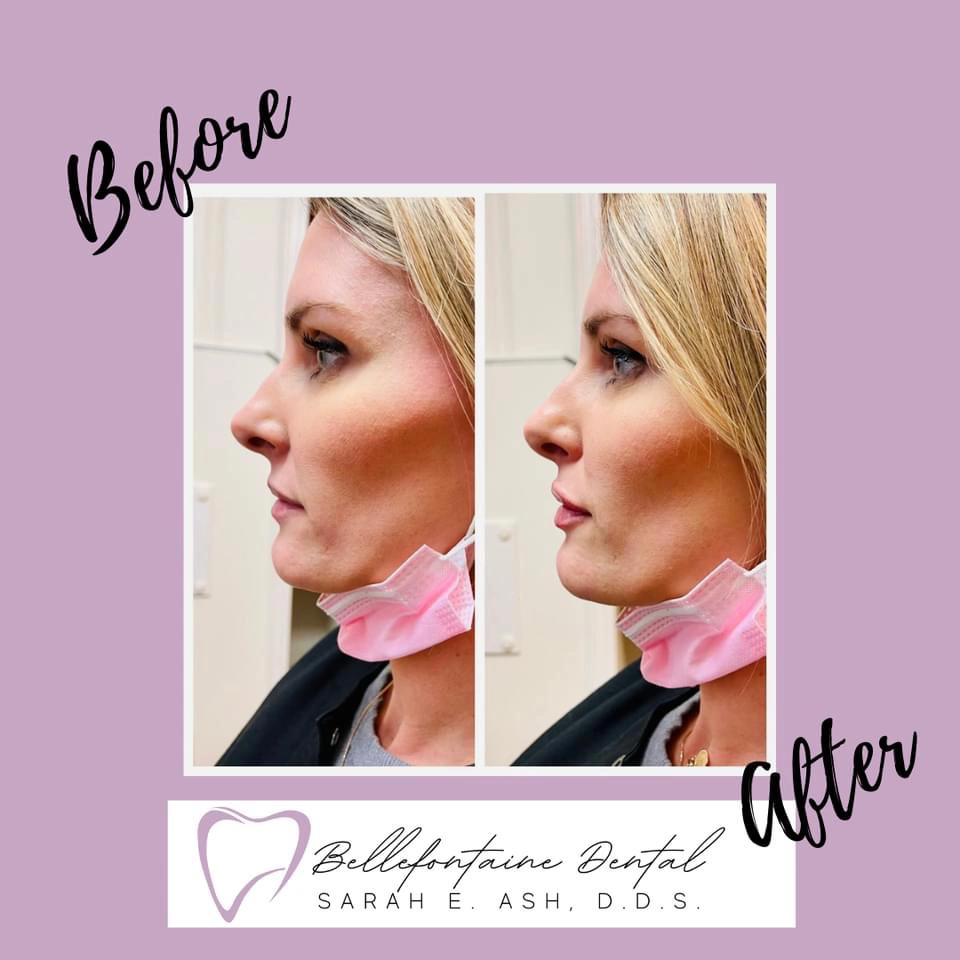 Bellefontaine Dental