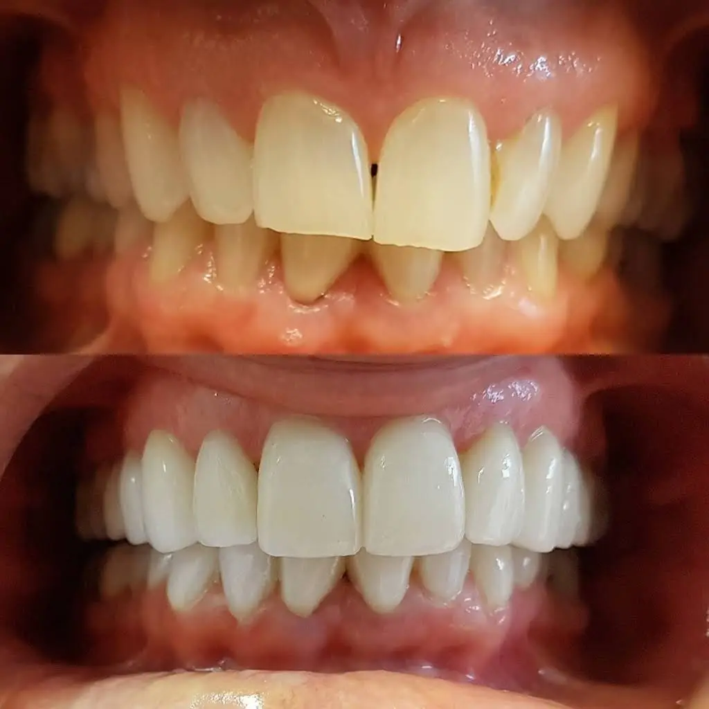 Smiles On Queen | Dentist Bolton