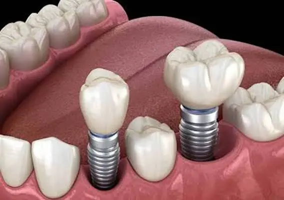 Tinsley Dentistry