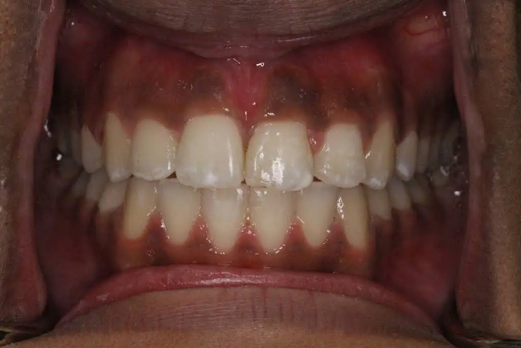 Flower City Dental