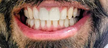 Kazman Family Dental