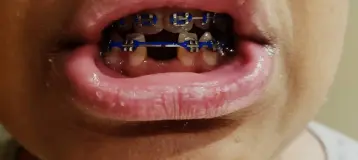 Smile Matters