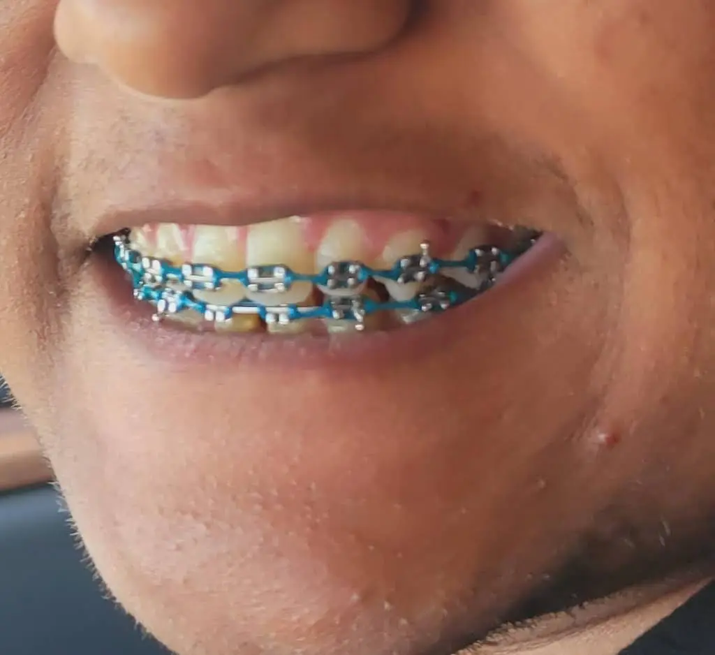 Smile Matters