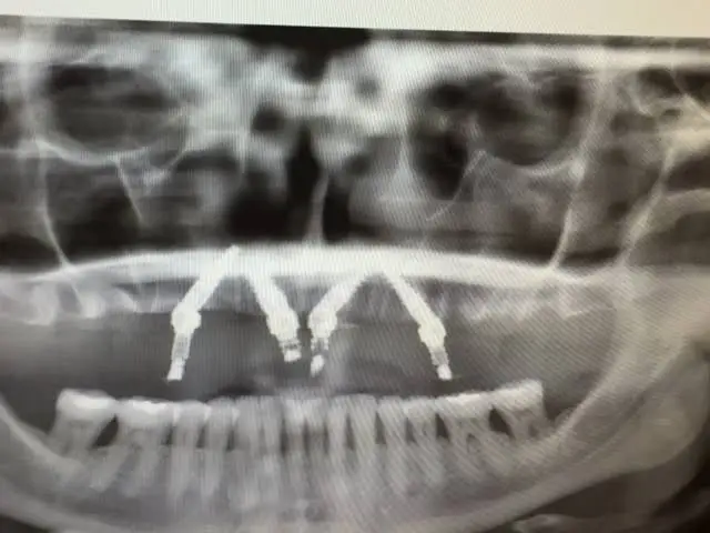 Ladd Dental Group of McCordsville