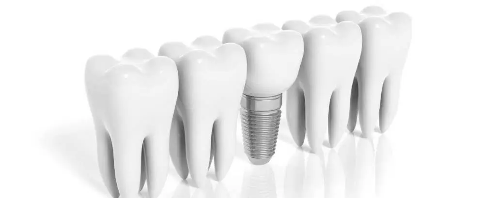 Simply Smile Dentistry