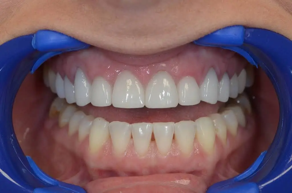 Advanced Family Dentistry