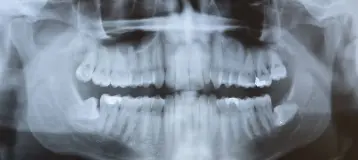 Northwest Family Dental of Marysville